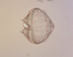 Protoperidinium