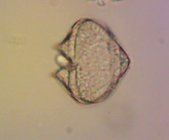Protoperidinium