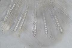 Pulvinula archeri