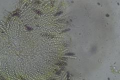 Ascobolus crenulatus