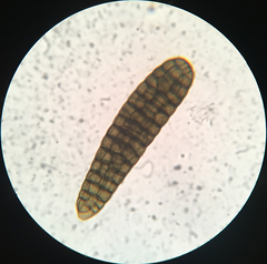 Berkleasmium concinnum