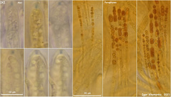 Hymenoscyphus dearnessii