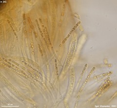 Hymenoscyphus dearnessii