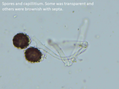 Scleroderma septentrionale