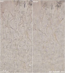 Hymenoscyphus dearnessii