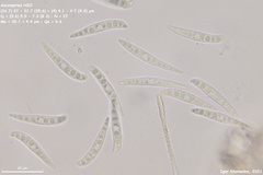 Hymenoscyphus dearnessii