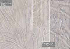 Hymenoscyphus dearnessii