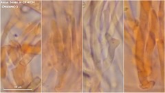 Hymenoscyphus dearnessii