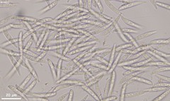 Hymenoscyphus dearnessii