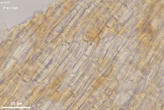 Hymenoscyphus dearnessii