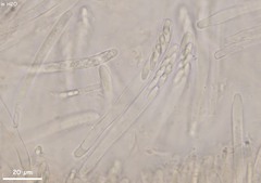 Hymenoscyphus vernus