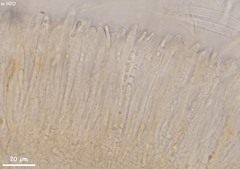 Hymenoscyphus vernus