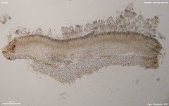 Hymenoscyphus vernus