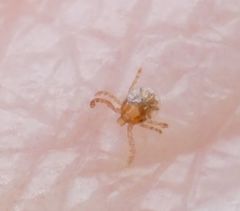 Amblyomma americanum