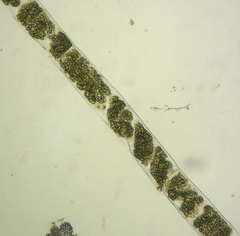 Spirogyra