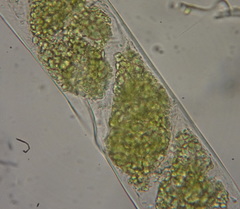 Spirogyra