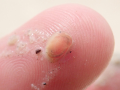 Cyzicidae