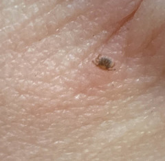 Amblyomma americanum