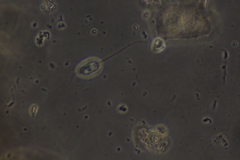 Anisonema acinus