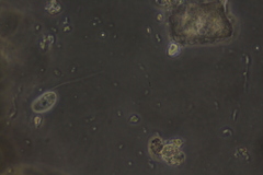 Anisonema acinus