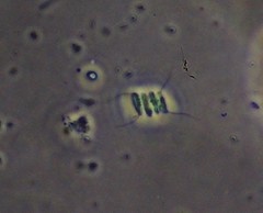 Scenedesmus