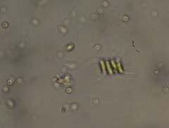 Scenedesmus