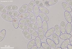 Peziza griseorosea