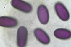 Ascobolus immersus