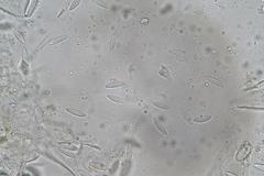 Ascozonus woolhopensis