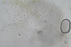 Ascozonus woolhopensis