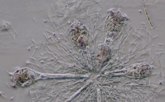 Conochilus unicornis