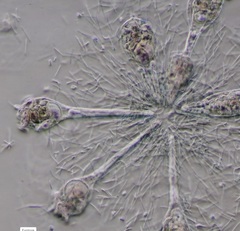 Conochilus unicornis