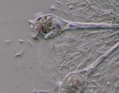 Conochilus unicornis