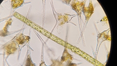 Pleurotaenium trabecula