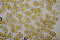 Puccinia graminis