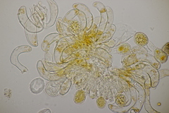 Phragmidium bulbosum