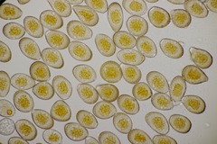 Puccinia graminis