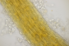 Cronartium flaccidum