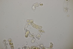 Cronartium flaccidum