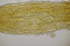 Cronartium flaccidum