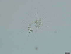 Asterionellopsis glacialis