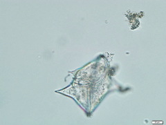Protoperidinium
