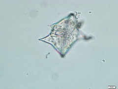 Protoperidinium
