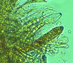 Belonioscyphella hypnorum