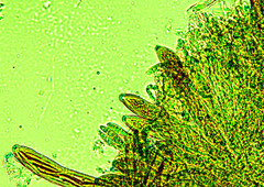 Belonioscyphella hypnorum