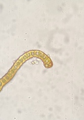 Racomitrium venustum