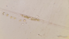 Cylindrotheca closterium