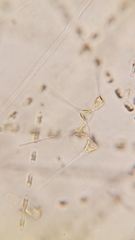 Asterionellopsis glacialis