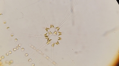 Asterionellopsis glacialis