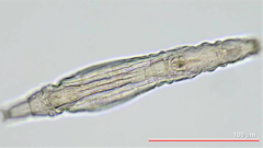 Macrotrachela ambigua